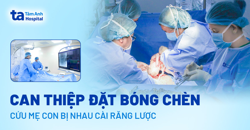 Cứu sản phụ bị nhau cài răng lược xuyên cơ tử cung vào bàng quang