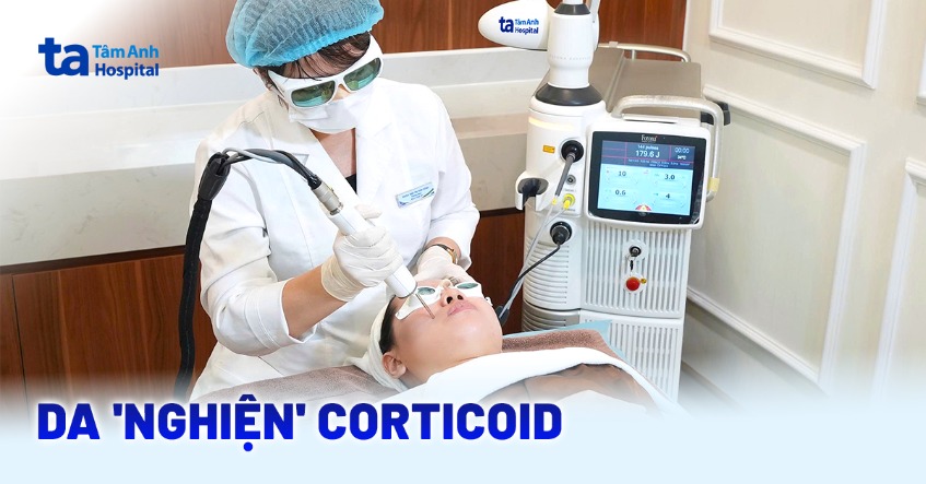 Cai “nghiện” corticoid cho da