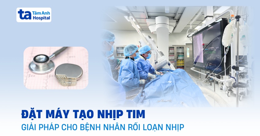 Đặt máy tạo nhịp tim: Giải pháp ngăn ngừa đột tử cho người rối loạn nhịp tim