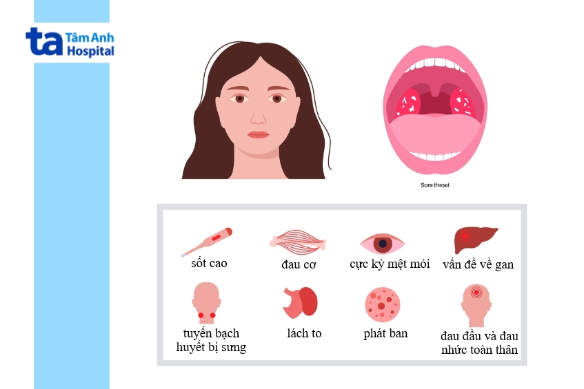 dấu hiệu bạch cầu đơn nhân