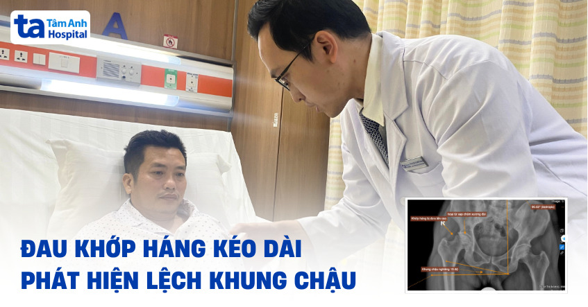 đau khớp háng kéo dài, phát hiện lệch khung chậu