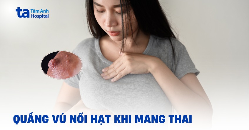Đầu nhũ hoa có hạt trắng khi mang thai là hiện tượng gì?