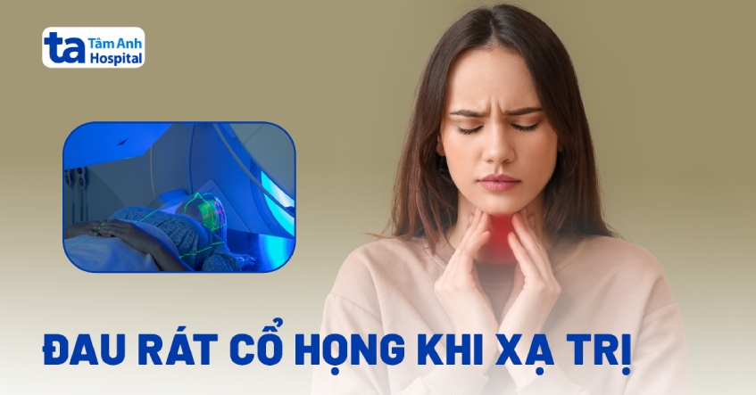 đau rát cổ họng khi xạ trị