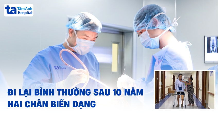 đi lại bình thường sau 10 năm hai chân biến dạng