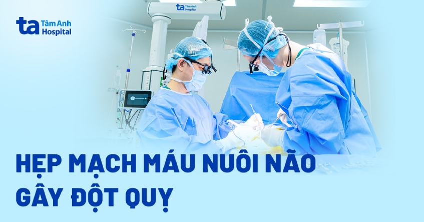 Đột quỵ mới biết hẹp mạch máu nuôi não