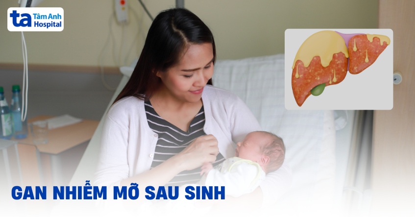 Gan nhiễm mỡ sau sinh: Dấu hiệu cảnh báo mẹ bỉm cần chú ý