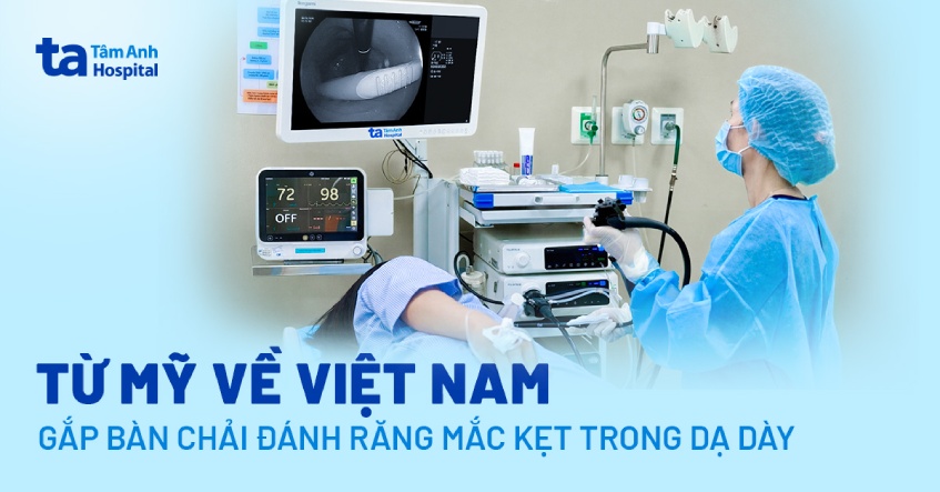 Từ Mỹ về Việt Nam gắp bàn chải đánh răng mắc kẹt trong dạ dày