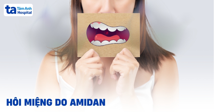 Vì sao hôi miệng do amidan và có đáng lo ngại?