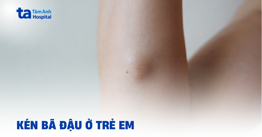 Kén bã đậu ở trẻ em được hiểu như thế nào?