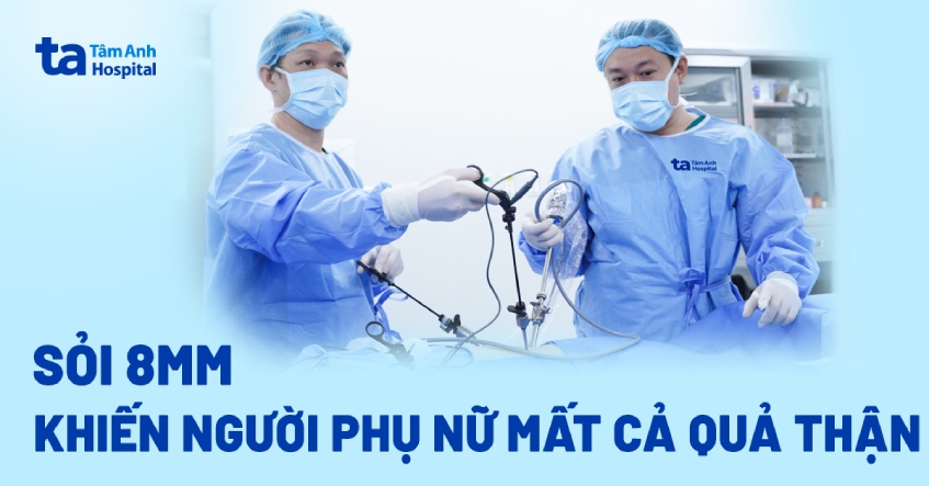 Sỏi 8 mm khiến người phụ nữ mất cả quả thận