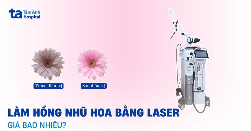 Làm hồng nhũ hoa bằng laser có hiệu quả lâu dài không?