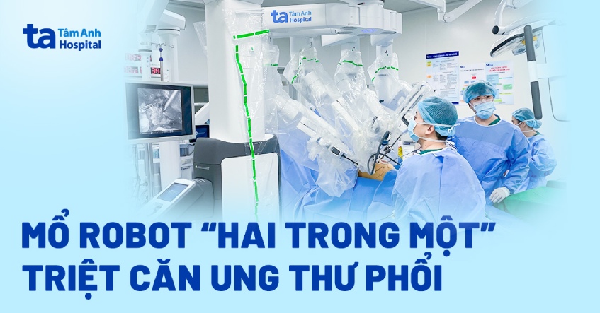 Mổ robot “2 trong 1” triệt căn ung thư phổi