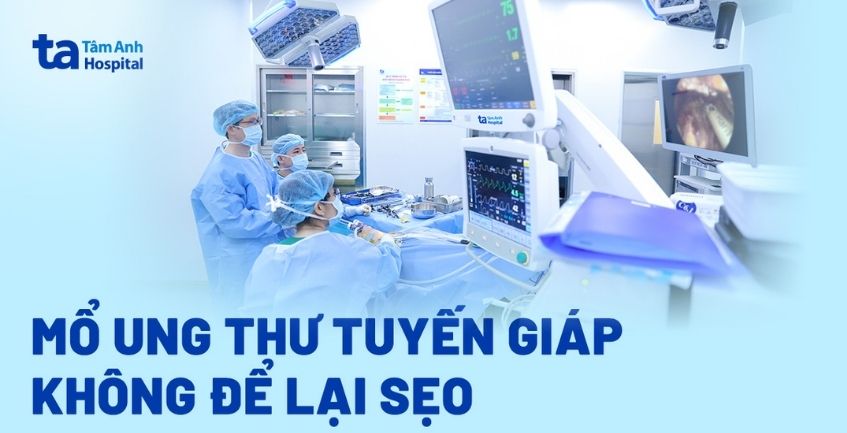 Phẫu thuật ung thư tuyến giáp không để lại sẹo