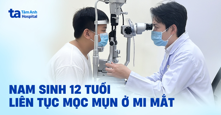 Nam sinh 12 tuổi liên tục mọc mụn ở mi mắt