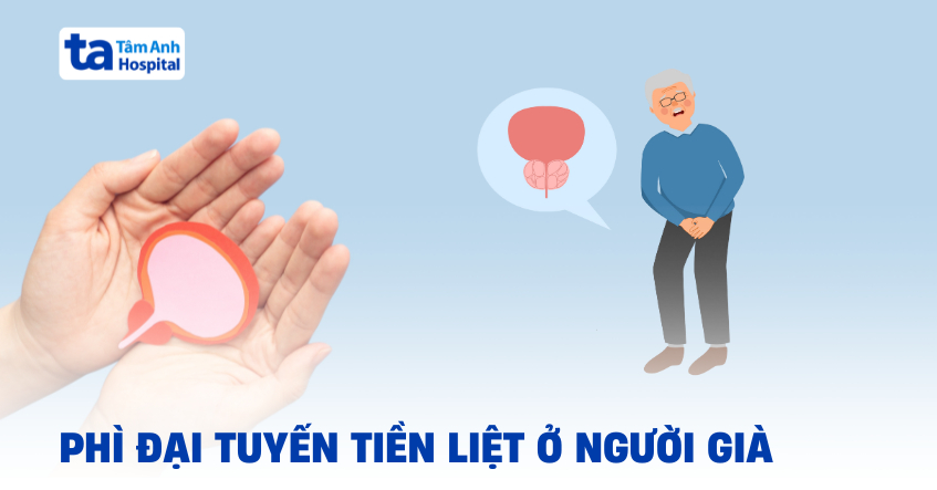 Người cao tuổi có bị phì đại tuyến tiền liệt không?