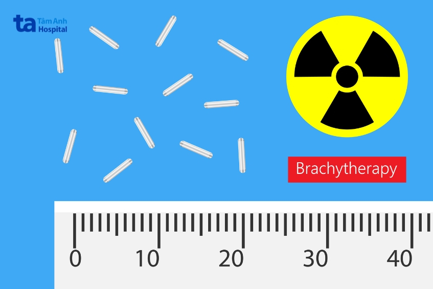 nguồn xạ dùng trong xạ trị áp sát thường có kích thước rất nhỏ