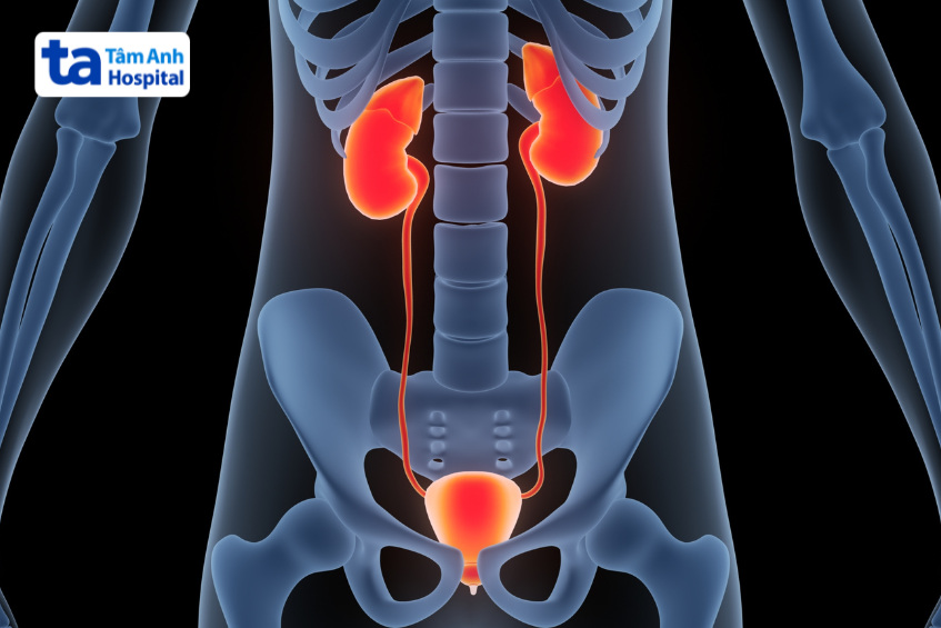 nguyên nhân gây ung thư niệu quản