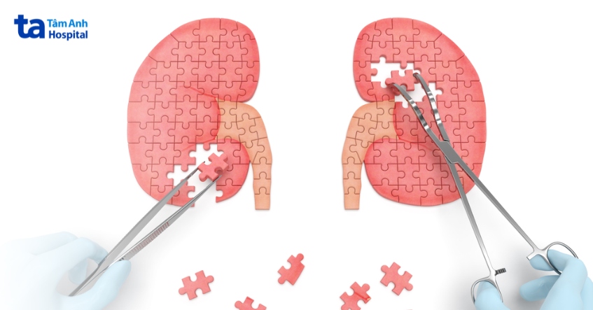 nhóm bệnh ở cầu thận di truyền