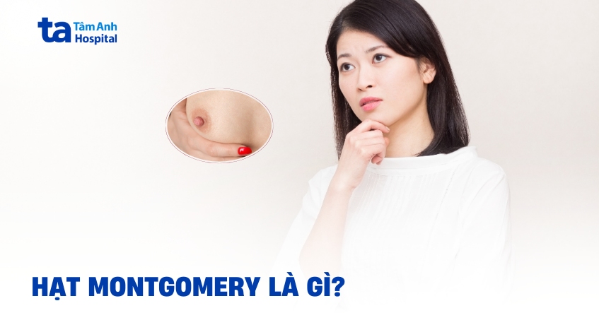 Hiểu thêm về nốt nhỏ xung quanh nhũ hoa (hạt montgomery)