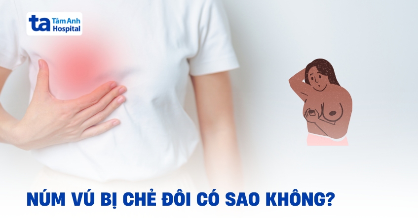 Núm vú bị chẻ đôi có sao không? Nguyên nhân do đâu?