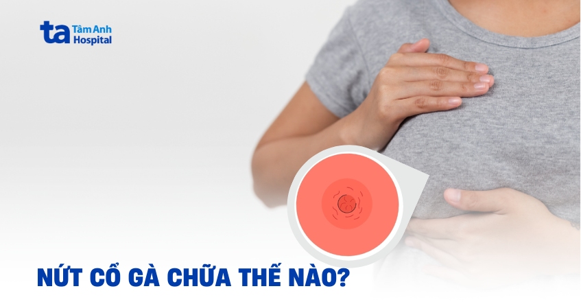 Nứt cổ gà phải chữa thế nào? Hình ảnh và nguyên nhân