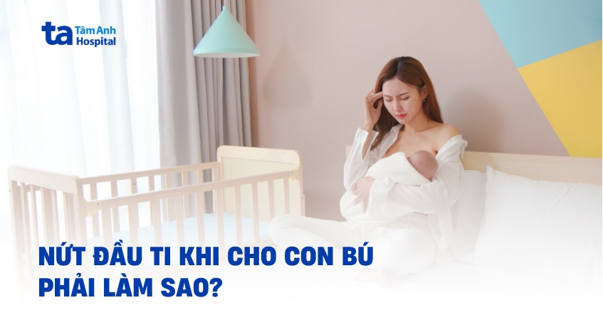 Nứt đầu ti khi cho con bú: Cách xử lý an toàn cho mẹ và bé