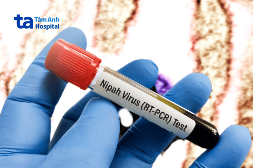 ống xét nghiệm virus nipah