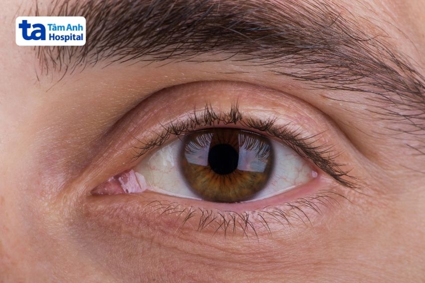 phản ứng mắt đánh giá mức độ ý thức