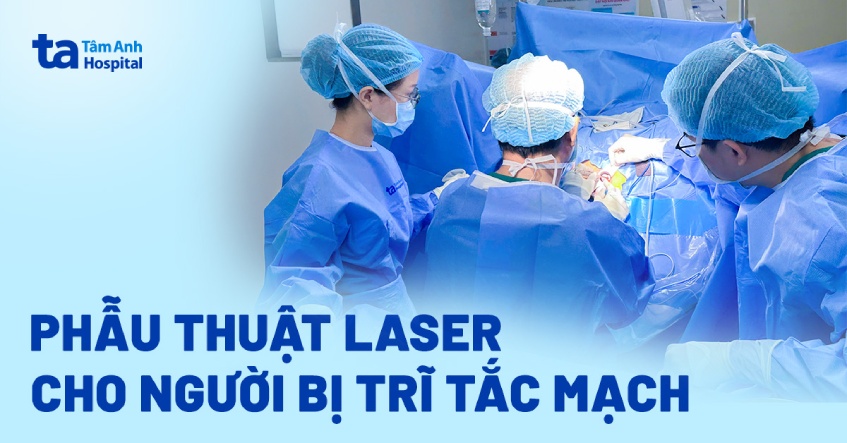 Phẫu thuật laser cho người bị trĩ tắc mạch