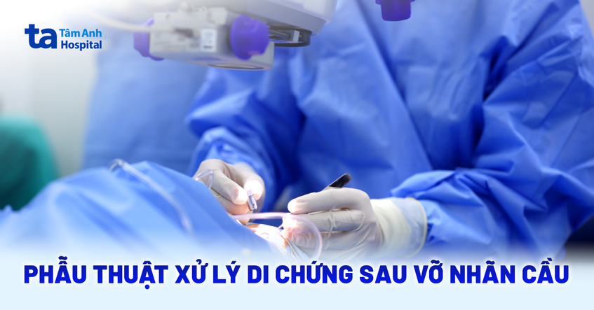 Phẫu thuật xử lý di chứng sau vỡ nhãn cầu