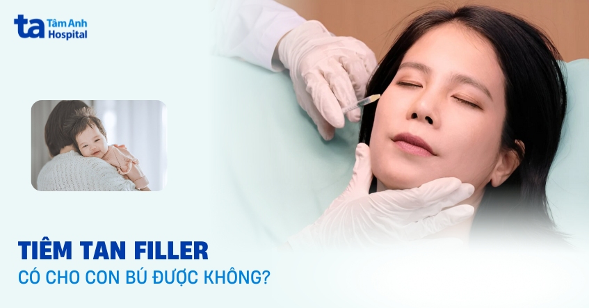 Đang cho con bú tiêm tan filler có sao không?
