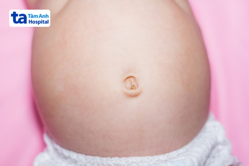 rốn bình thường sau khi rụng cuống rốn