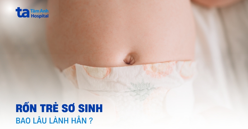 Chuyên gia tư vấn: Rốn trẻ sơ sinh bao lâu thì lành hẳn?