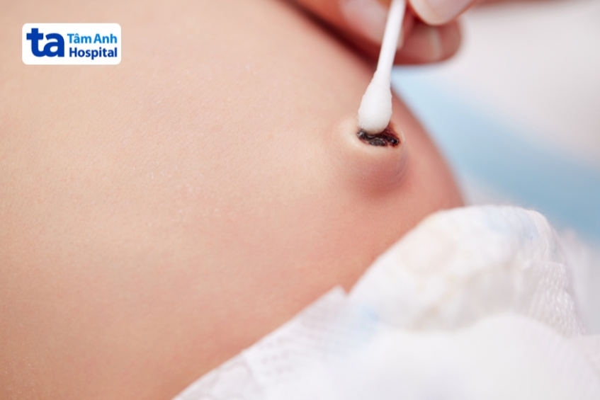 rốn trẻ sơ sinh mới rụng cuống rốn