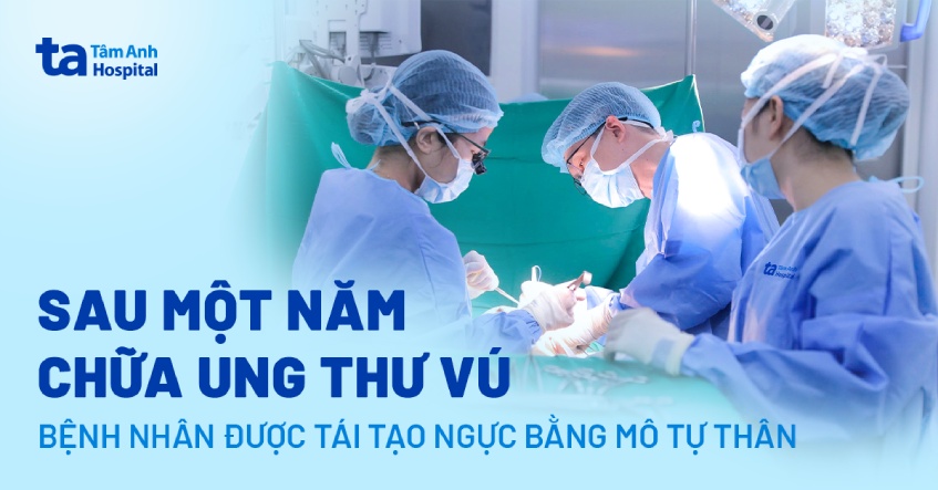 Sau một năm chữa ung thư vú, bệnh nhân được tái tạo ngực bằng mô tự thân