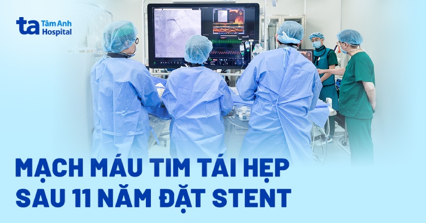 Tái hẹp mạch vành sau 11 năm đặt stent