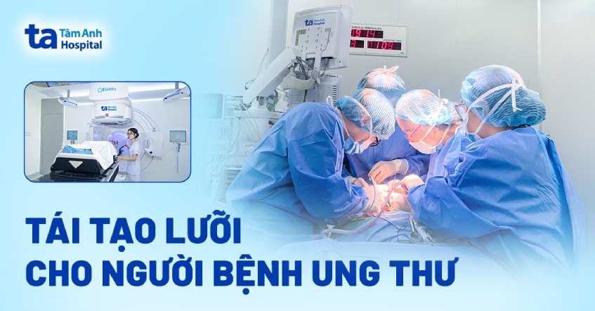 Tái tạo lưỡi cho người bệnh ung thư
