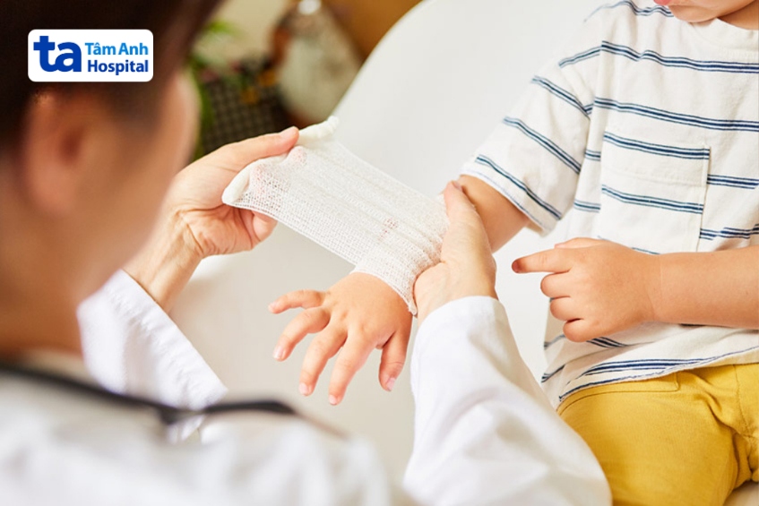 té ngã là tai nạn phổ biến ở trẻ và có thể gây chấn thương nghiêm trọng