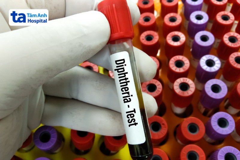 test dự phòng bệnh bạch hầu