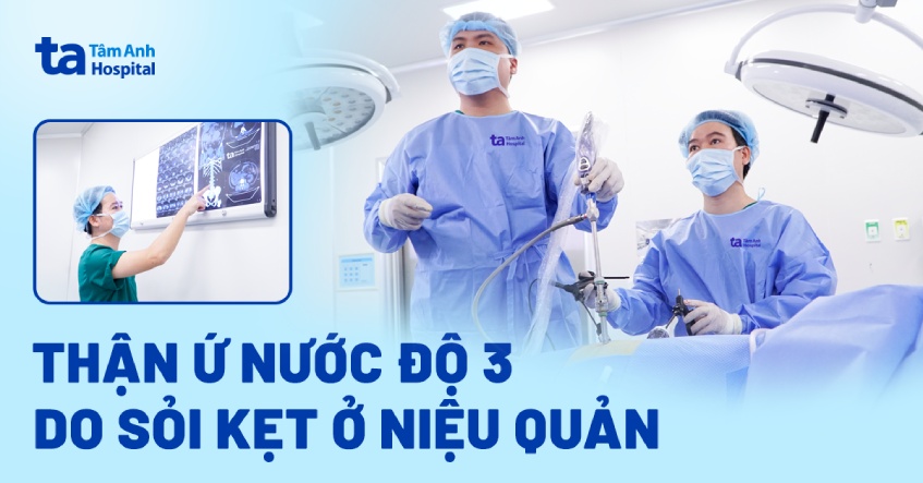 Thận ứ nước độ 3 do sỏi kẹt ở niệu quản