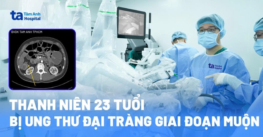 Thanh niên 23 tuổi bị ung thư đại tràng giai đoạn muộn