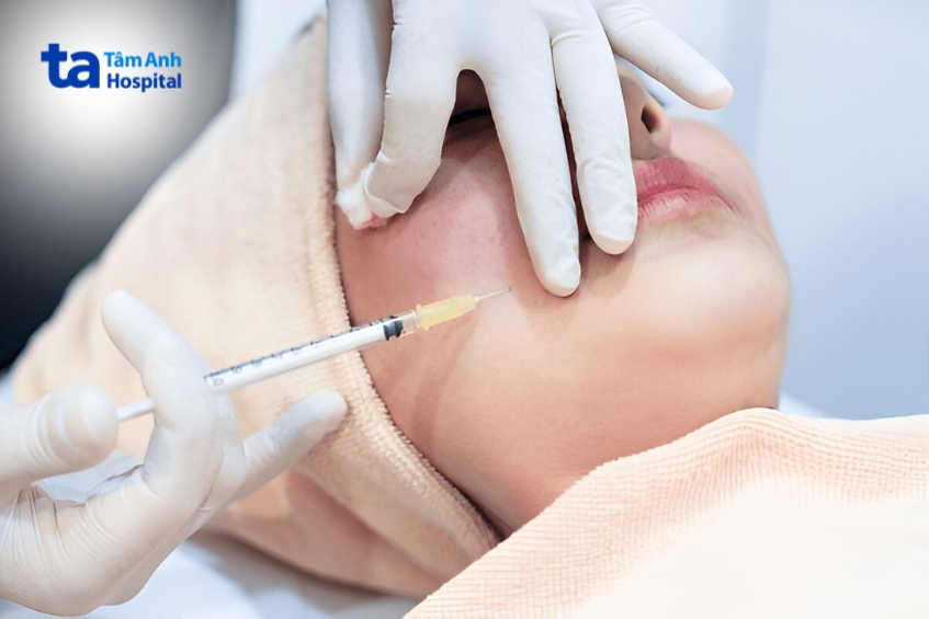 tiêm tan filler có ảnh hưởng đến sữa mẹ không