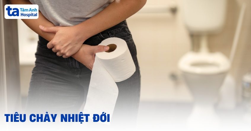 Đừng chủ quan với tiêu chảy nhiệt đới (sprue nhiệt đới)