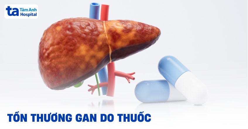 Tổn Thương Gan Do Thuốc