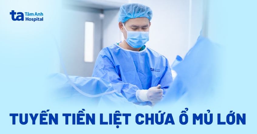 Tuyến tiền liệt chứa ổ mủ lớn