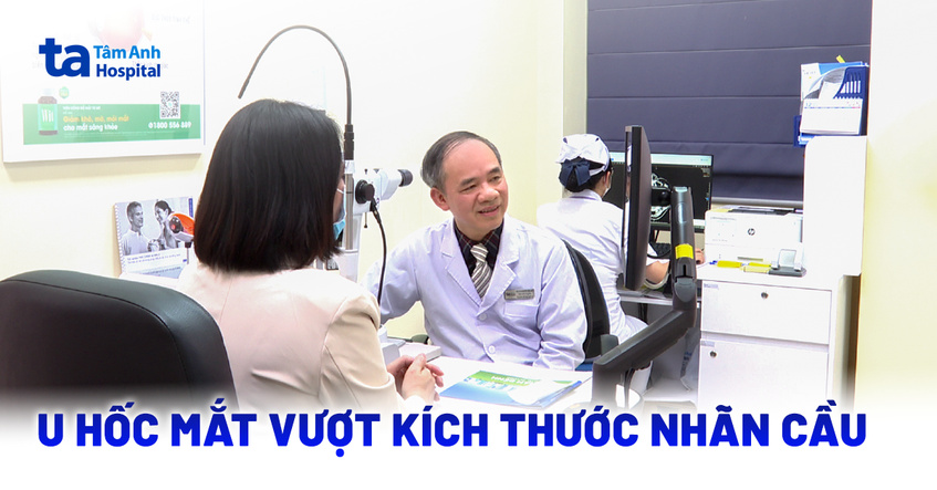 U hốc mắt vượt kích thước nhãn cầu