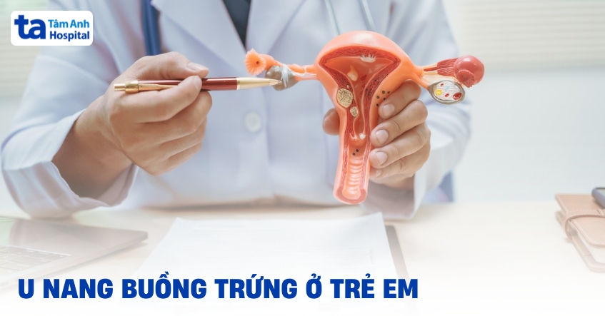 U nang buồng trứng ở trẻ em có xảy ra không? Điều trị thế nào?