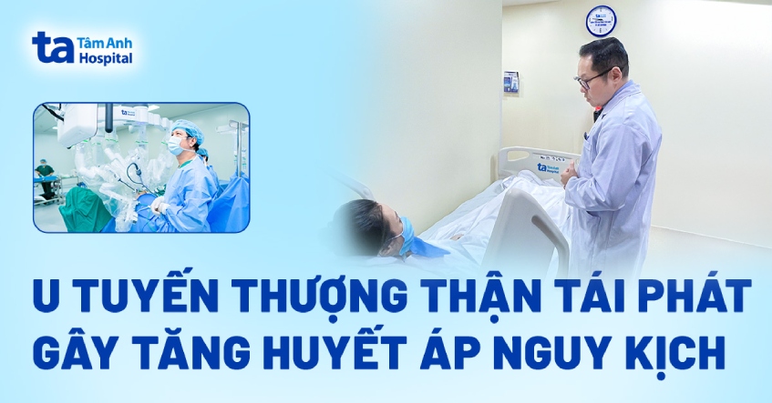 U tuyến thượng thận tái phát gây tăng huyết áp nguy kịch