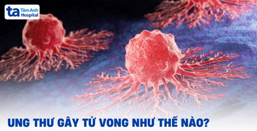 Ung thư gây tử vong như thế nào?