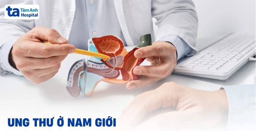 Tổng hợp các bệnh ung thư ở nam giới phổ biến hiện nay